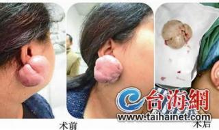 广州哪里打耳洞比较好呢要专业安全卫生一点的 哪里可以打耳洞